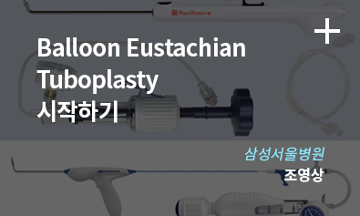 Balloon Eustachian Tuboplasty / 삼성서울병원 조영상