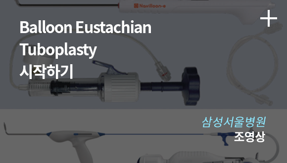 Balloon Eustachian Tuboplasty / 삼성서울병원 조영상