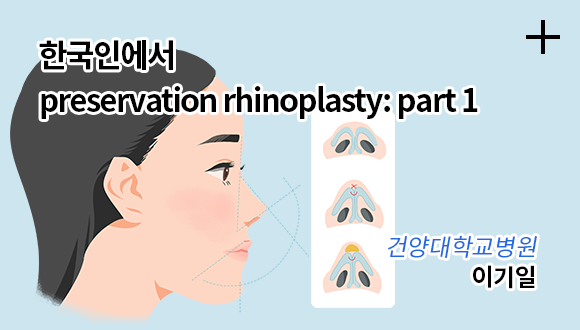 한국인에서 preservation rhinoplasty part 1 / 건양대학교병원 이기일