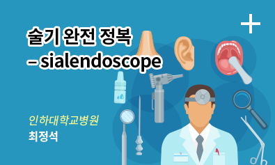 술기 완전 정복 – sialendoscope