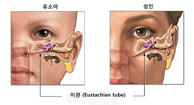 유소아와 성인의 이관 비교 그림