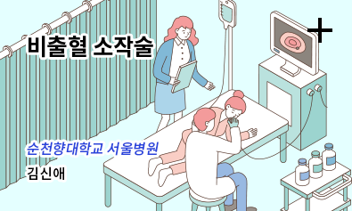 비출혈 소작술. 순천향대학교 서울병원 - 김신애