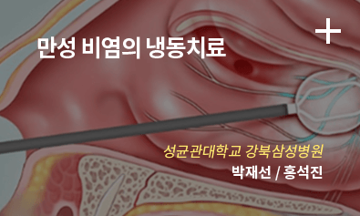 만성 비염의 냉동치료 - 성균관대학교 강북삼성병원 박재선 / 홍석진