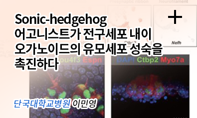 Sonic-hedgehog어고니스트가 전구세포 내이 오가노이드의 유모세포 성숙을 촉진하다 / 단국대학교병원 이민영