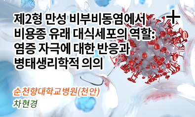 제2형 만성 비부비동염에서 비용종 유래 대식세포의 역할: 염증 자극에 대한 반응과 병태생리학적 의의